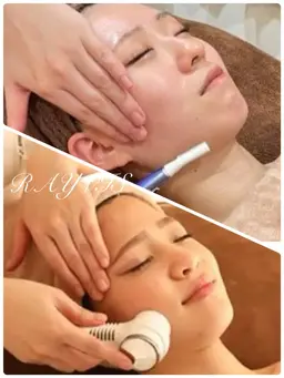 🎅Xmasまで限定　🌹パーフェクト美肌顔脱毛🌹《脱毛＋フェイシャルのWケア♡》 3980円→2980円