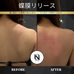 【🦋肩甲骨ライン×姿勢美】蝶膜リリース｜背中・首・肩を整える背中特化ケア〈都度払いOK〉