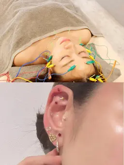 【耳ツボジュエリー👂💎＋電気美容鍼】お体の不調は耳ツボで！（学割500円OFF）
