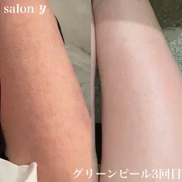 グリーンピールボディ1day(2パーツ)【体のざらつきをスベスベに】