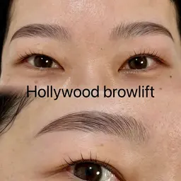 ハリウッドブロウリフト