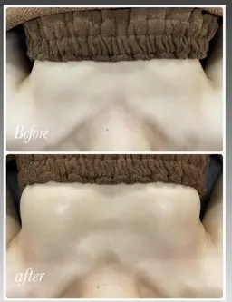 ふわふわバストケア🫶❤️目指せスフレおっぱい&お碗型バスト❗️