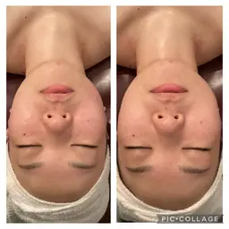 【期間限定】💕時短/即効性＆小顔コルギ💕　40分　　デコルテ、首リンパ、ヘッドスパ、美容マスク付き♪