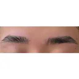 シートワックス脱毛