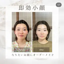 速攻小顔オーダーメイド100分