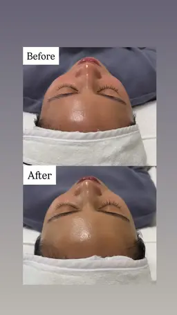 先行予約受付中【4/1​〜​20限定】🏆ビフォーアフターコンテスト参加枠✨コンテスト協力特別Thankyou(39)価格!