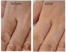 エイジングケア☆ハンドエステ＋ジェル1,2カラー