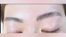 ハリウッドブロウリフト（HBL）