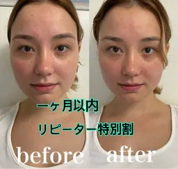 一ヶ月以内のリピーター♻️特別🈹！