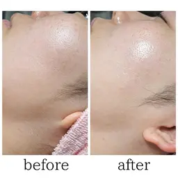 【ワックス脱毛】フェイス　お顔の産毛&毛穴ケアに◎　今だけコラーゲンパック付き♪