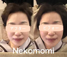 【劇的小顔コルギ＆オイルリンパマッサージ】90分　小顔コルギ➕30分デトックスボディオイルリンパマッサージ