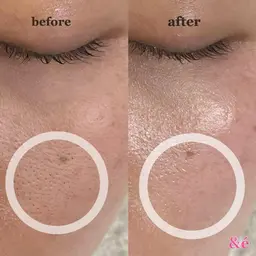 全顔フェイシャルワックス※必ずメニュー内容を確認後にご予約ください