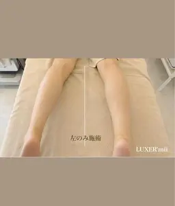 本気の脚痩せ▷▷美脚コルギ70分（骨盤付）ヒップアップ、膝上の肉、セルライト、足首などなど気になるところ任せてください！