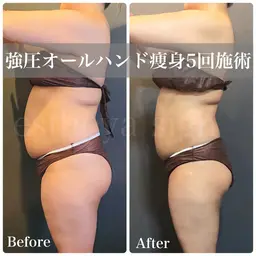 ◆モニター募集◆【ダイエット/むくみ/首肩凝り】全身強圧リンパ90分