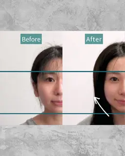 よもぎの力でお顔スッキリ！小顔矯正×おキュウ×微痛小顔コルギ→70分