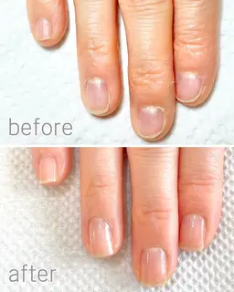 自爪育成《最強のネイルケア3ヶ月コース》1回お試し体験◎噛み爪/むしり癖/深爪/貝爪/平らな爪/二枚爪