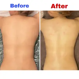 【18​〜​29歳女性限定💃】浮腫とおさらば❗️リンパドレナージュ🍃