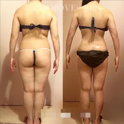 ボディライン　90分20800円→5990円カウンセリング➕施術時間約120分