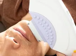 【ヒゲ脱毛】メンズ1番人気！ルミクスa9で毎日のお手入れから解放！