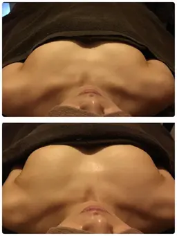 ミラクルバスト