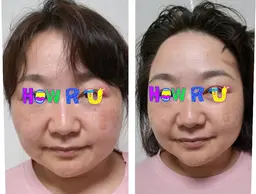 小顔整体(歪みを、整えて小顔に導きます)