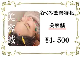 【口コミ限定】むくみ改善特化♪♪電気美容鍼￥4,500