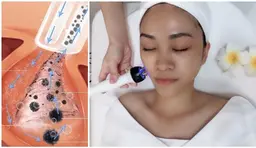 毛穴角栓・黒ずみ洗浄ハイドロフェイシャル+ハイパ-＋ハンド¥7980→¥6580