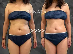 ¥全員使える/冷却❄️痩身　お好きな部位8箇所モニター