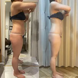 ウィンバックボディーコース　当日相談