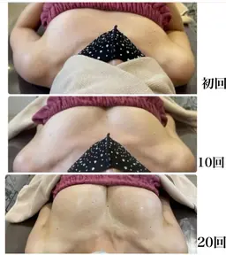 人気NO.2 左右差離れ胸撃退⭐