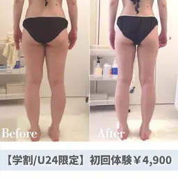 ​🉐【ミニモ学割/U24】トリプル溶解痩身45分✨美脚・くびれ・二の腕・ハミ肉など気になるところを集中ケア✨