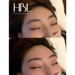 【女性】ハリウッドブロウリフト