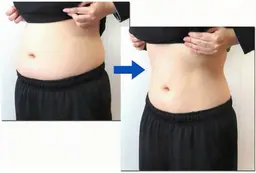 【食事制限が続かなかった方へ】3ヶ月で無理なく痩せる初回ダイエットカウンセリング