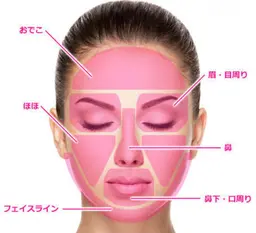 フェイシャルwax脱毛（全体）