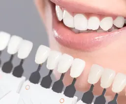 プレミアムホワイトニング1セット|初回体験