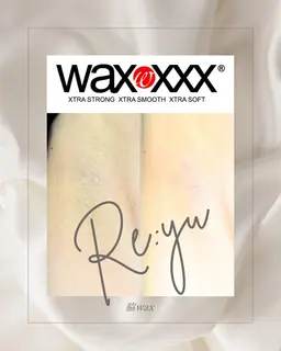 両脇wax脱毛