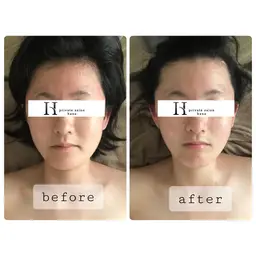 【たるみ撃退❗️小顔リフトケア60分】浮腫み老廃物を流し筋肉を引き上げリフトアップへ💆‍♀️