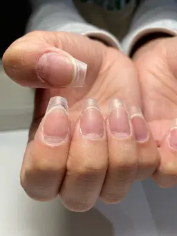 長さ出し1本(チップのみ)