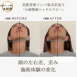 たるみ！えらはり！顔の歪み撃退！無痛の若見え小顔整顔ヘッド！新感覚！全身骨格調整×深層リンパ×小顔整顔