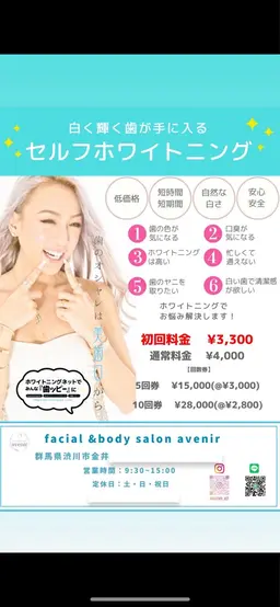 歯のセルフホワイトニング