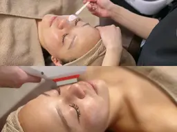 人気NO.1★【フェイシャルMIX脱毛】¥11,500→¥9,500 浸透力・メイクのりUP💖