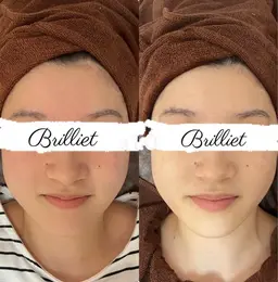 ミニモ限定価格✨小顔リフトアップ✨当店人気NO.1 【次世代小顔】ハイパー小顔と美肌