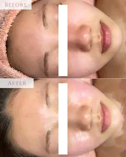 2/16空き◎プレミアム艶肌Wax✨毛穴洗浄＋ワックスでツヤ肌へ導く極上ケア☆産毛・角質・皮脂をごっそり‼️