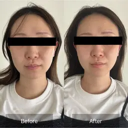 【お年玉企画】美覚醒 ヘッドマッサージ