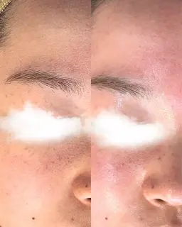 【当店おすすめ！】速攻韓国肌wax