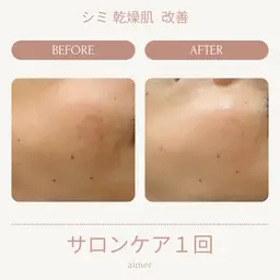 透明感が欲しい方におすすめ！“細胞活性機械“セルサー美白コース＊女性限定＊マッサージつき