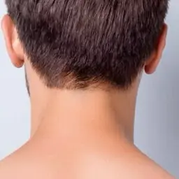 ✨うなじ脱毛✨