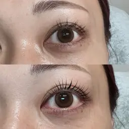 マーメイドラッシュリフト🧜‍♀️上まぶた