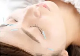 美顔鍼＋30分KYT整体