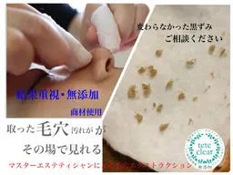 【いちご鼻、毛穴つまりが気になる方】毛穴エクストラクション＋角質ケア
